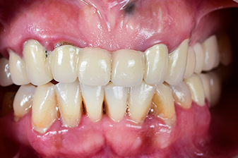 症例１０ビフォー