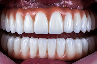 症例１０アフター