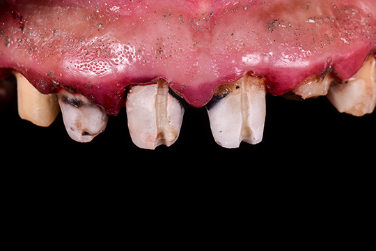 症例２ビフォー