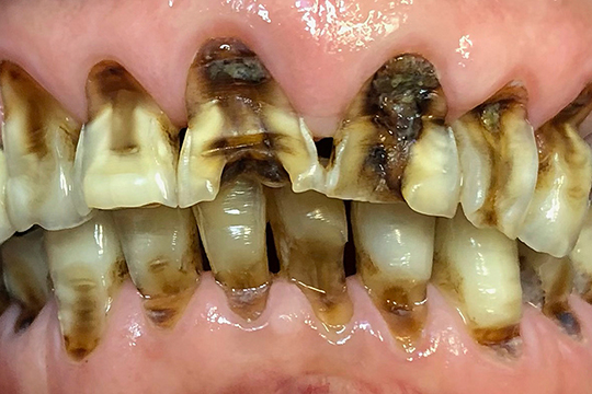 症例４ビフォー