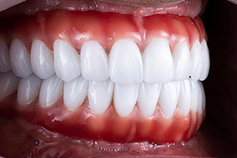 症例６アフター