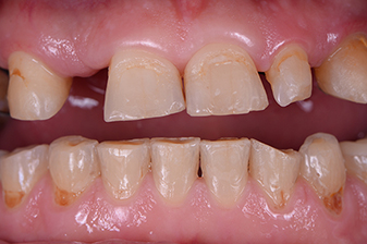 症例７ビフォー