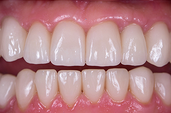 症例７アフター