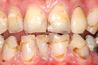 症例８ビフォー