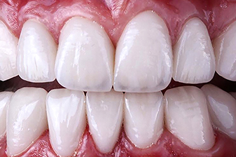 症例８アフター