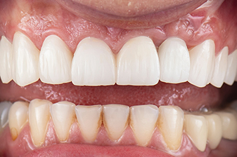 症例９アフター