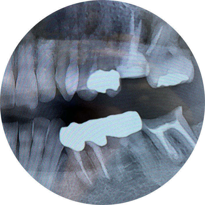 保険治療を繰り返している方
